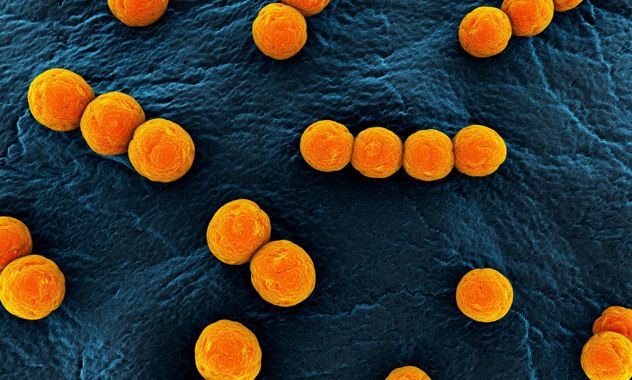 Enterococcus-Faecium-L